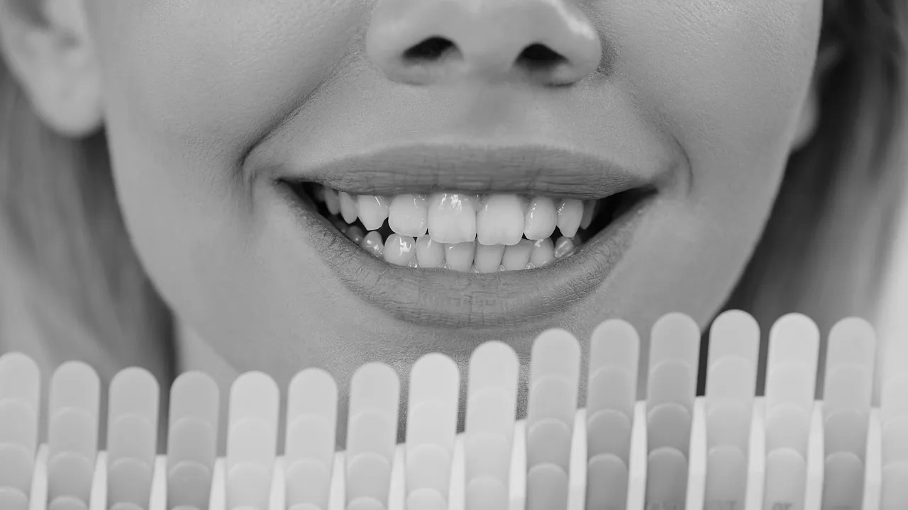 Dantų balinimo juostelės: ar trumpalaikis rezultatas neatsilieps ilgalaike žala?
